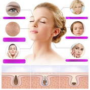 LumiThera - High-Frequency Skin & Eye Care Wand with Ozone Technology-2