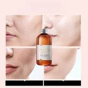 RoseHydra Mist - Nourishing Rose Water Toner for Dry Skin Care-3