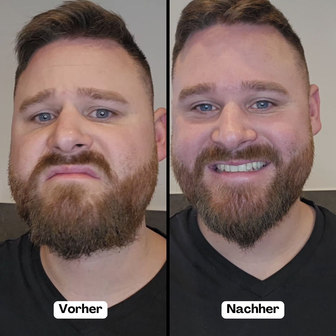 Beardmaster | Wireless negative ions style style-4