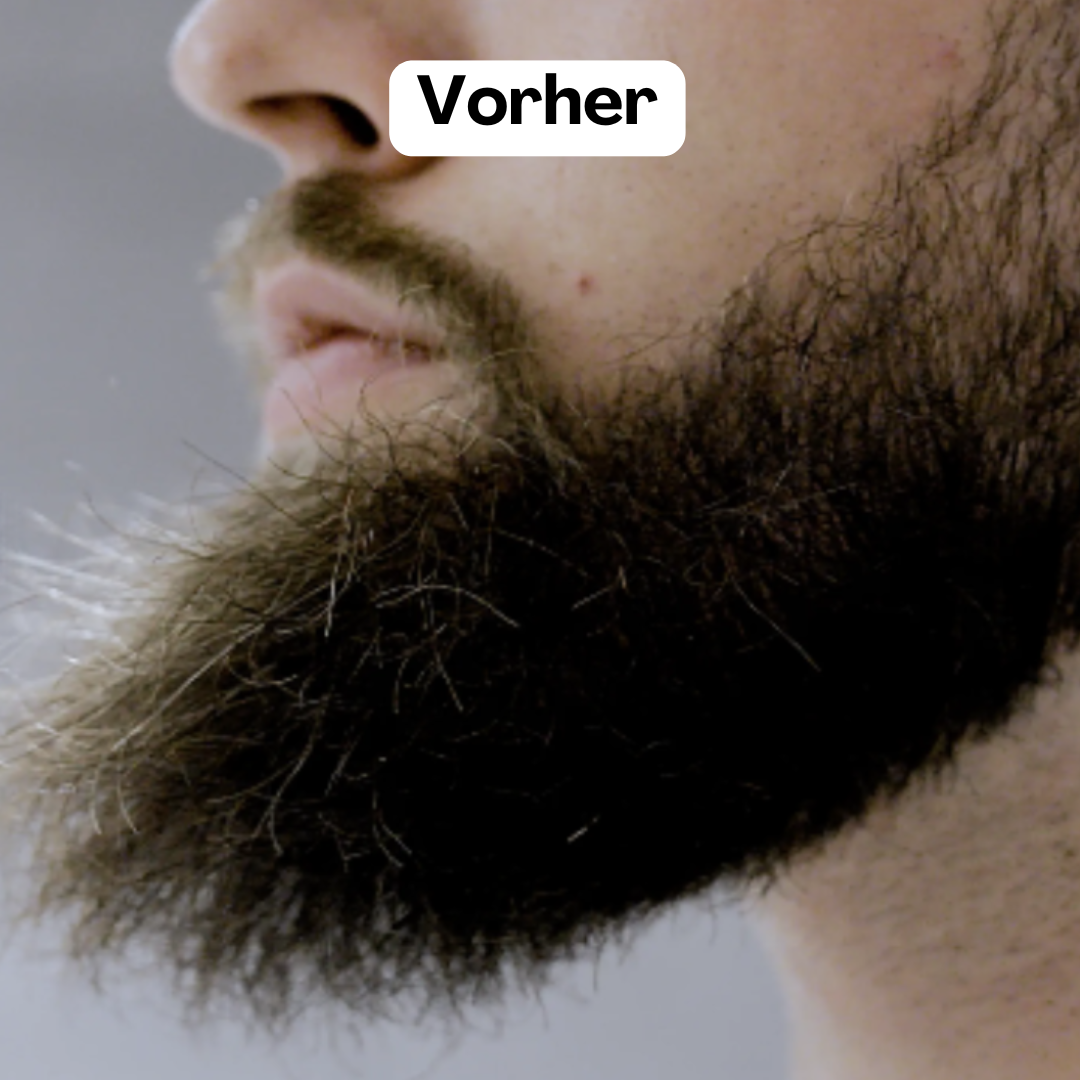 Beardmaster | Wireless negative ions style style-6