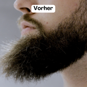 Beardmaster | Wireless negative ions style style-6